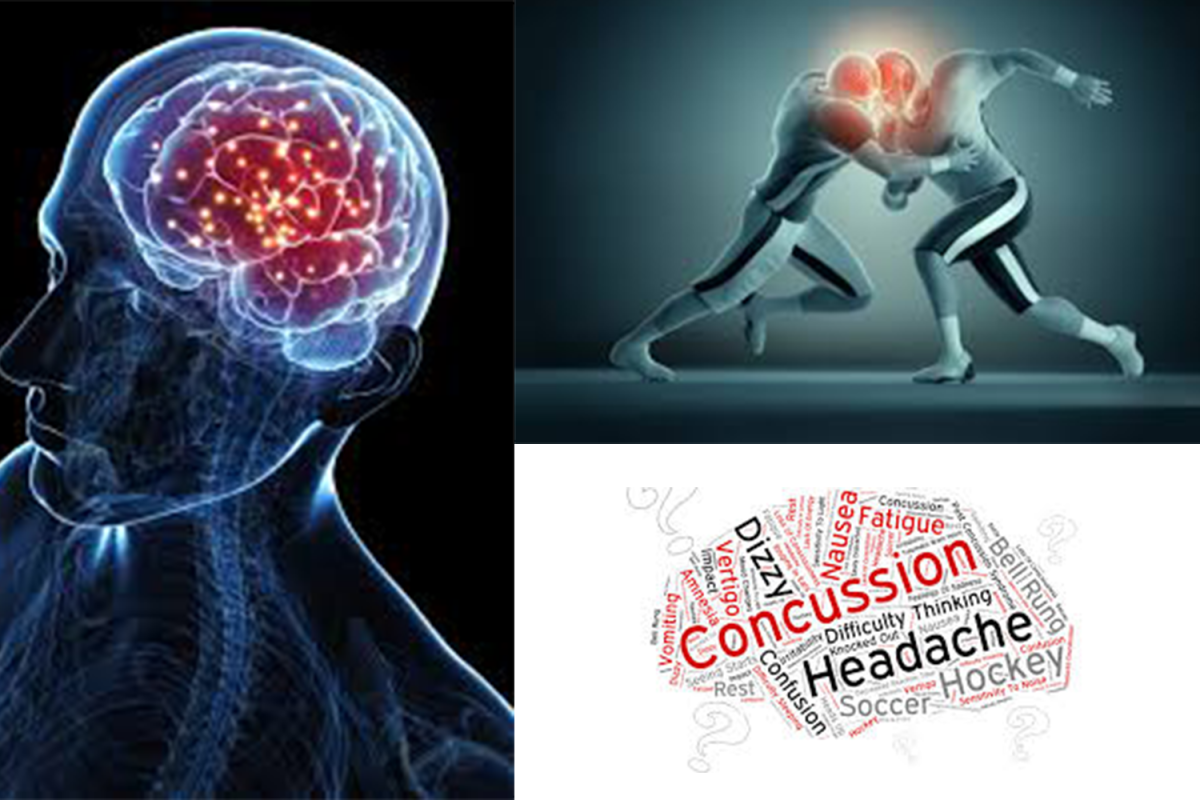 Athletes remain prone to sustaining at least one concussion. 